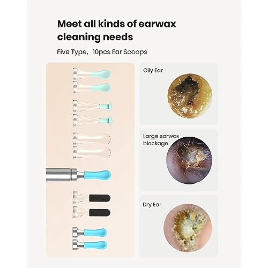BEBIRD R1 Wax Removal Tool for Ear - Spade Ear Canal Cleaner with Camera 1080P Earscope, Wax Remove Ear Picker with Vari Replac